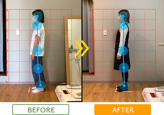 ビフォーアフター