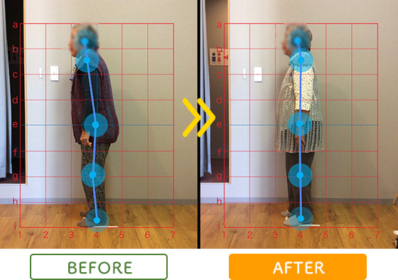 ビフォーアフター